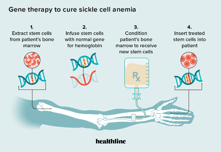 opening_gene_therapy.png